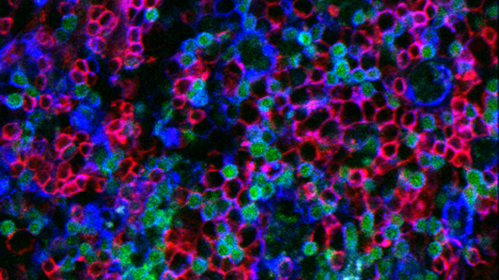 Interactions among germinal center B cells (red) and IL-21 (green) expressing CD4 helper T cells (blue) during malaria parasite infection.