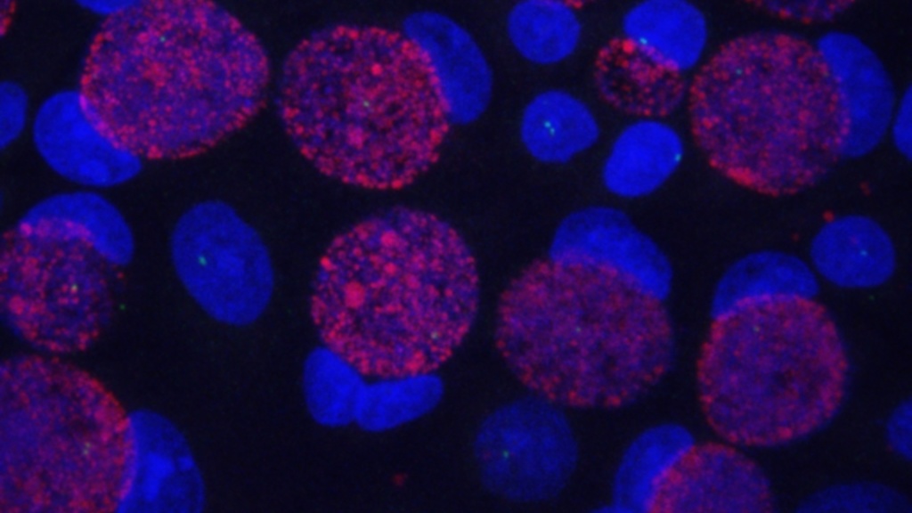 Bacteria Weber Lab centrosome counts