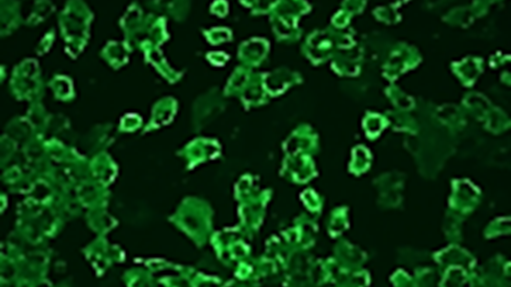 Virology Nucelocapsid Li Wu lab